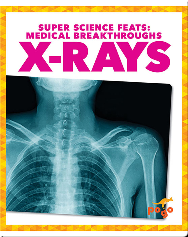 Medical Breakthroughs: X-Rays