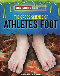 The Gross Science of Athlete’s Foot