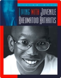 Living with Juvenile Rheumatoid Arthritis