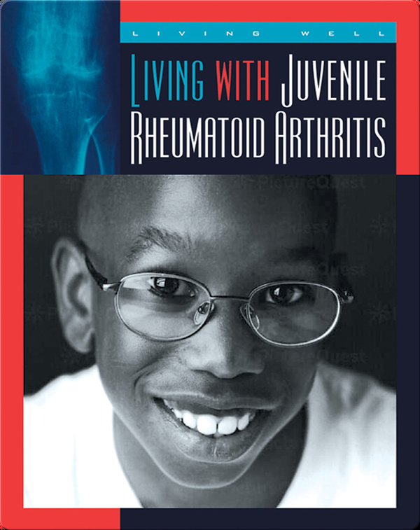 Living with Juvenile Rheumatoid Arthritis