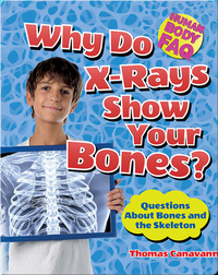 Why Do X-Rays Show Your Bones?: Questions About Bones and the Skeleton